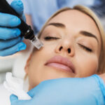 Person receiving microneedling treatment