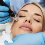 Person receiving microneedling treatment
