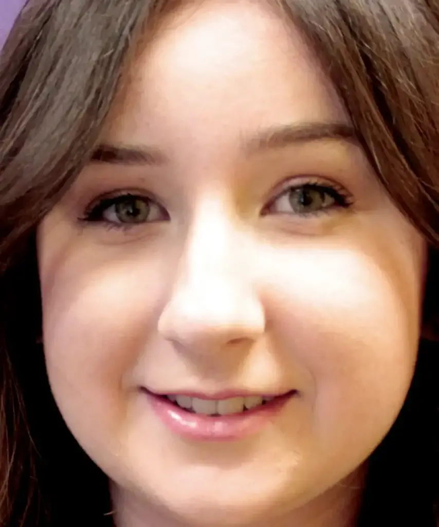 Moxi for acne - after treatment