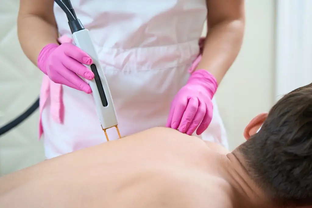 What Is Permanent Laser Hair Removal