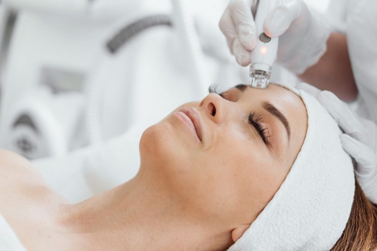 Secret RF Microneedling