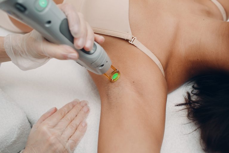 Hands Laser epilation and cosmetology. Hair removal cosmetology procedure. Laser epilation and