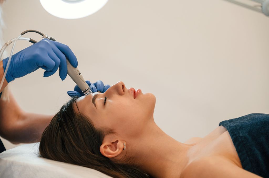 What is Secret RF Microneedling