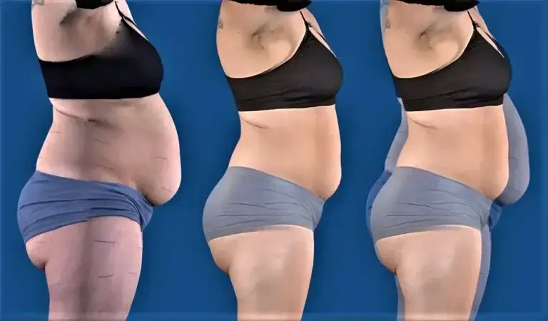 Medical Weight Loss provides real results at NAWI Wellness in Naples, FL