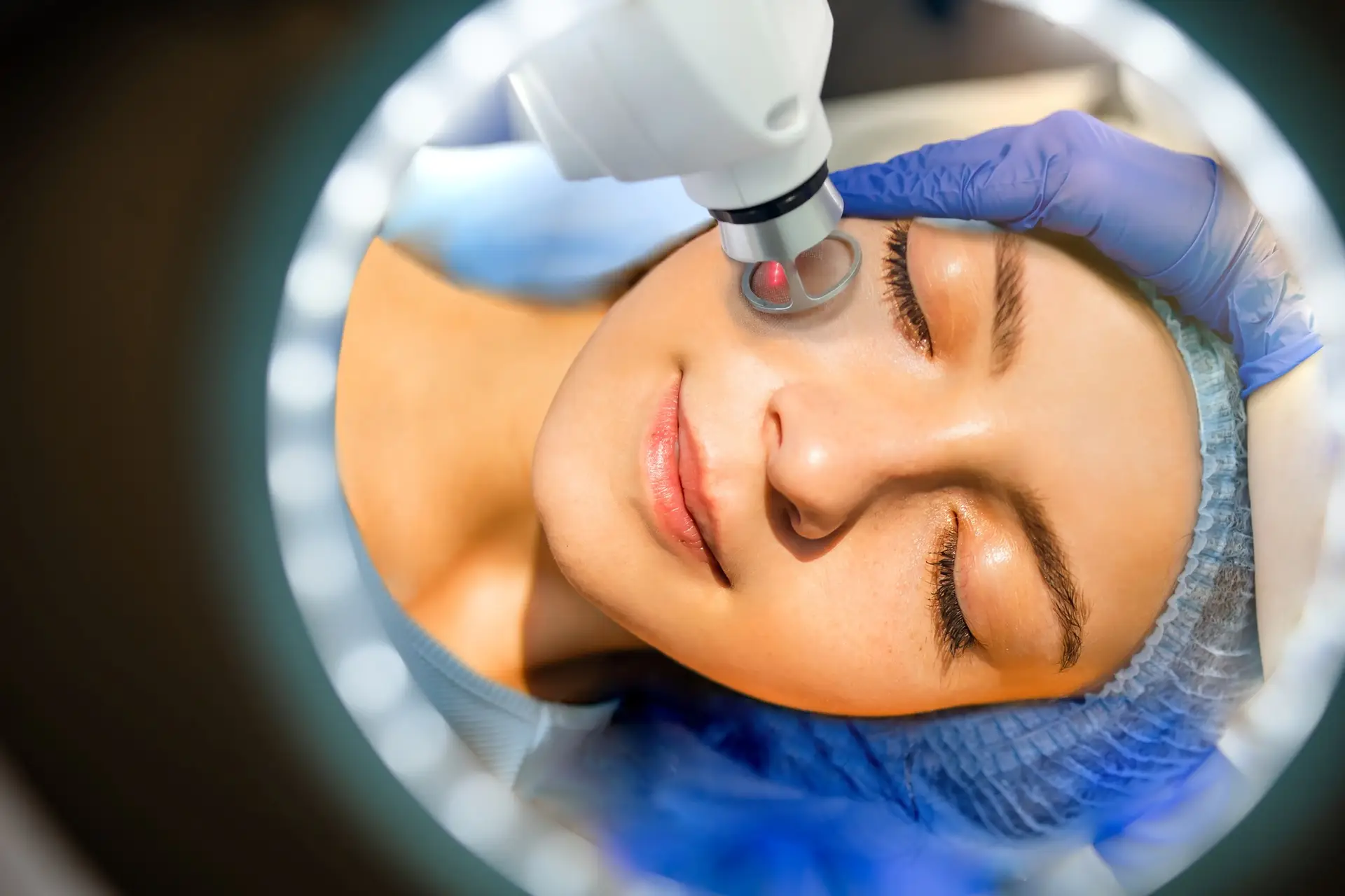 Juliet Erbium Laser Treatment Addresses Sun-damaged Skin at NAWI Wellness in Naples, FL