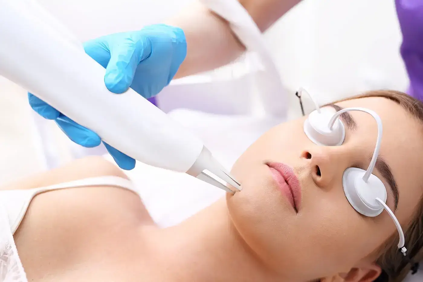 Juliet Erbium Laser Treatment rejuvenates the skin at NAWI Wellness in Naples, FL