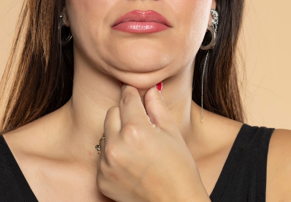 kybella treatment nawi