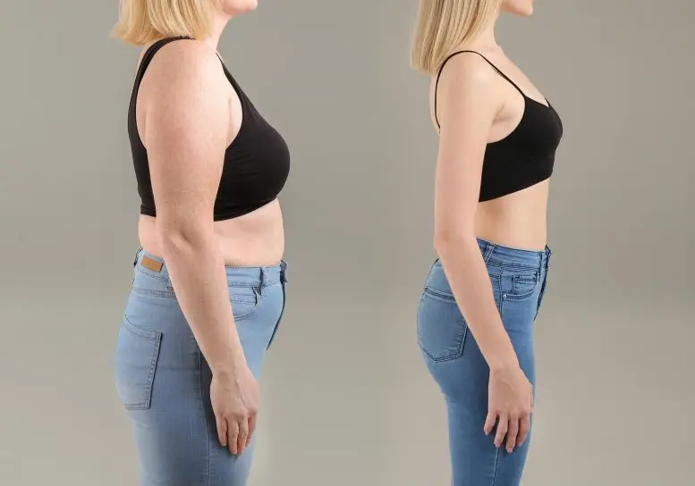 Semaglutide medical weight loss produces real results at NAWI Wellness, Naples, FL